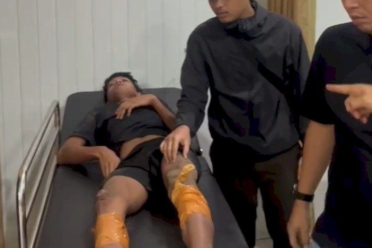 Mengaku 40 Kali Beraksi, Begal Eks Geng Motor Ditembak di Langkat