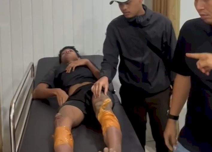 Mengaku 40 Kali Beraksi, Begal Eks Geng Motor Ditembak di Langkat